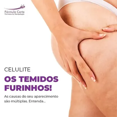 Fórmula Manipulada Celulite